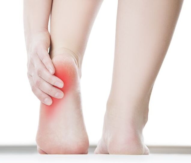 A wart on the heel causes intense pain